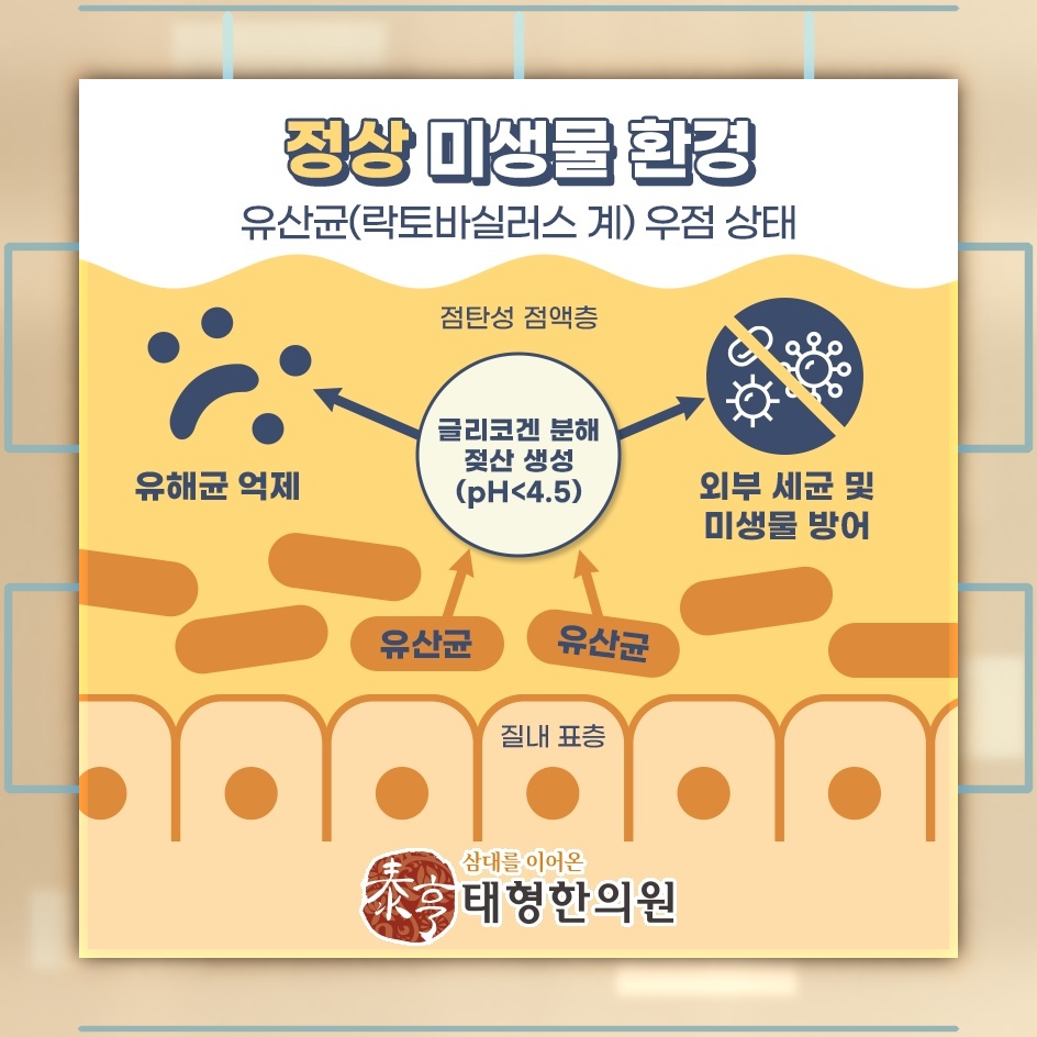 질염의 주요 원인과 증상을 차분히 살펴보기