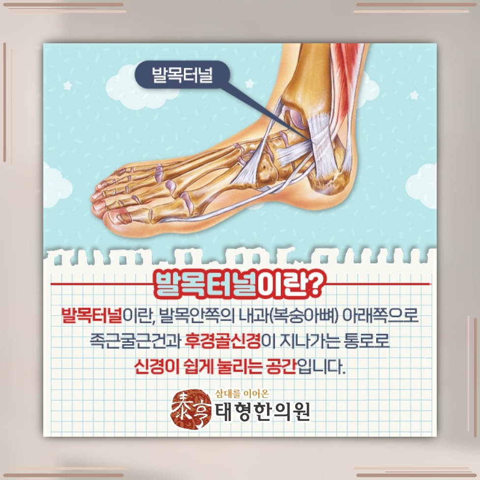 발목 안쪽에 나타나는 저림과 통증, 발목터널증후군