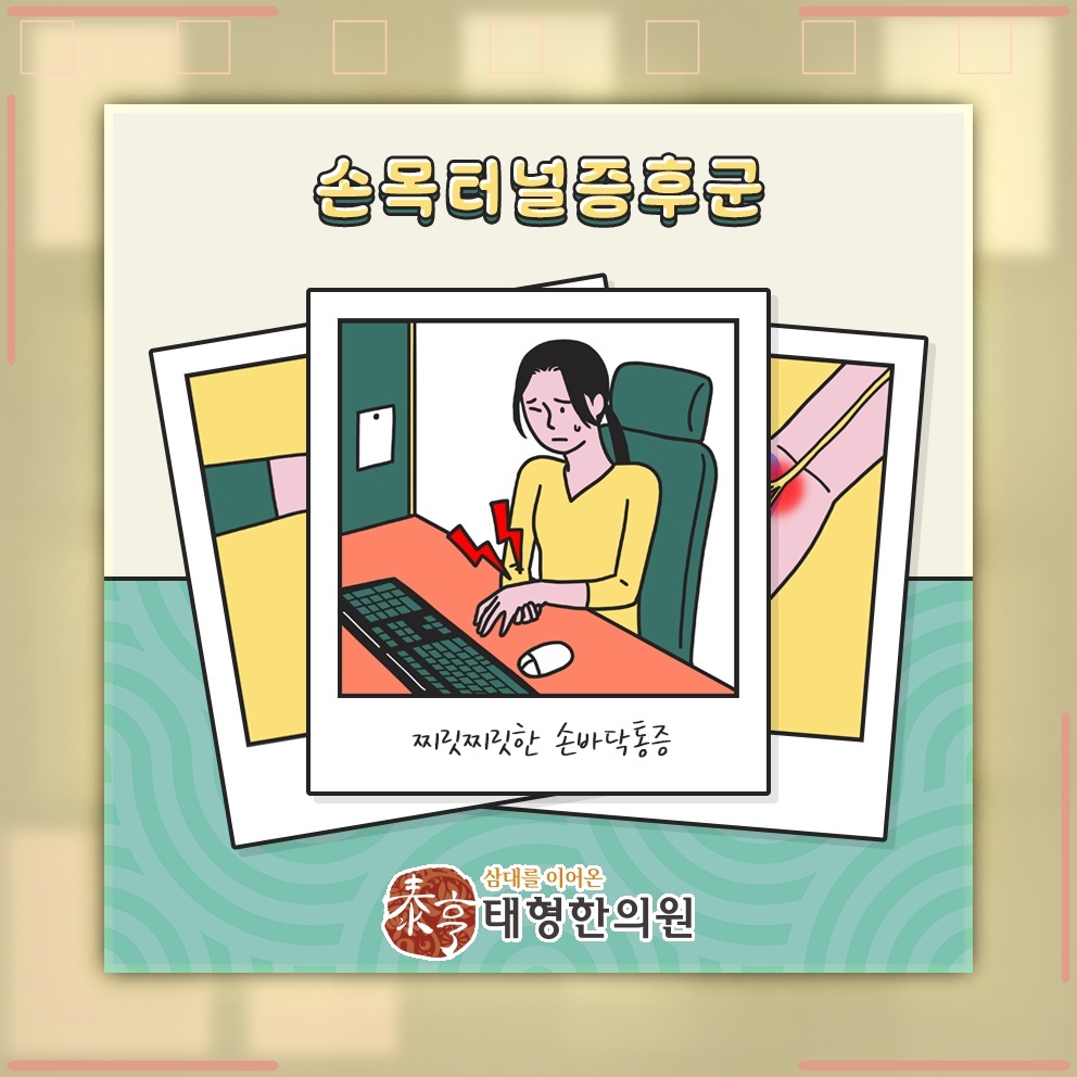 손목터널증후군, 손 저림과 통증이 이어질 때 확인할 점