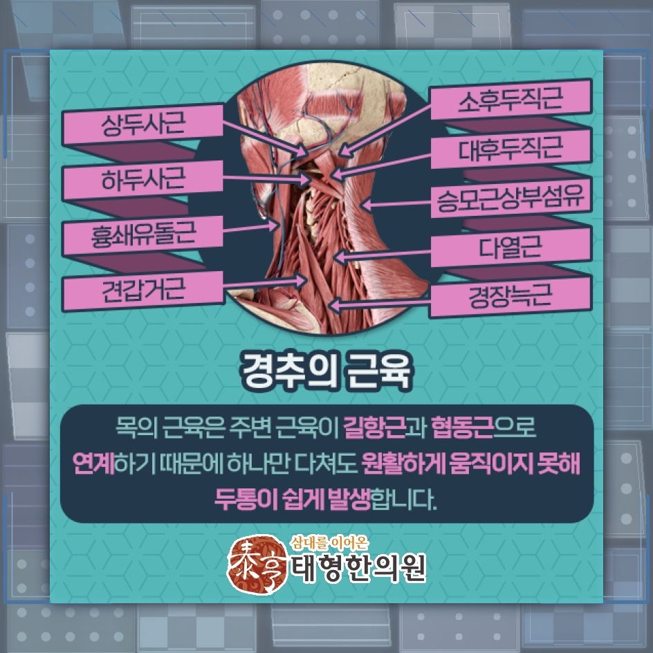 목 불편감과 함께 이어지는 경추성두통의 주요 양상