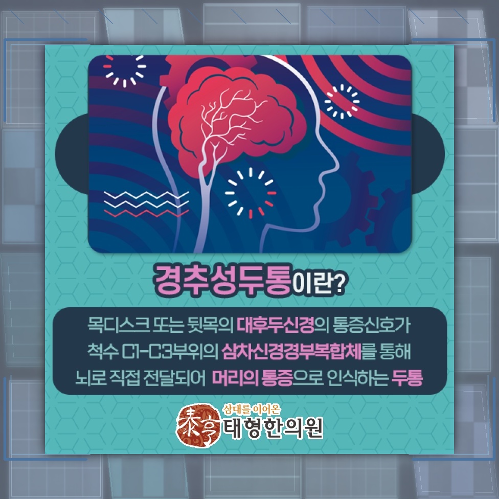 목 불편감과 함께 이어지는 경추성두통의 주요 양상