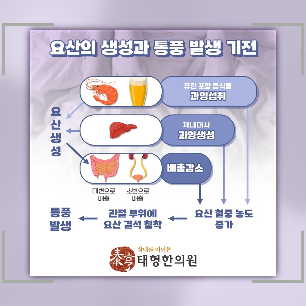 혈액 속 요산이 높을 때 살펴보는 통풍의 발생 배경