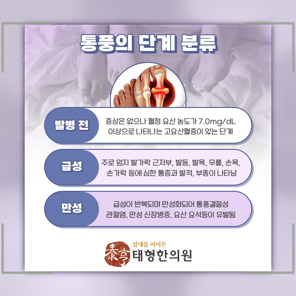 혈액 속 요산이 높을 때 살펴보는 통풍의 발생 배경