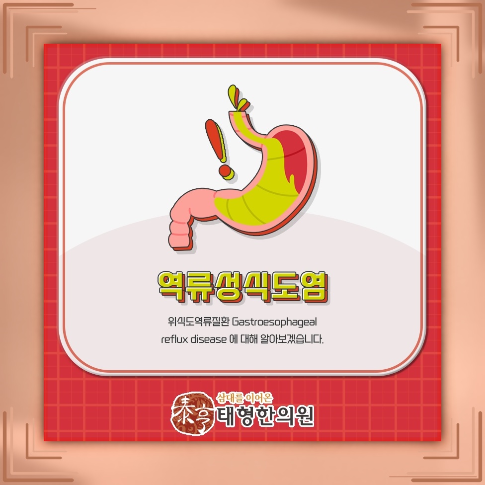 식후 가슴 쓰림과 신물이 반복될 때 역류성식도염