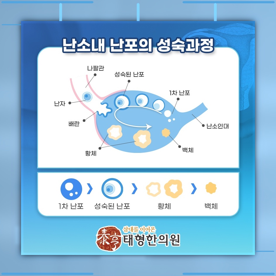 석 달 넘게 생리 주기가 흐트러졌다면 다낭성난소증후군 점검