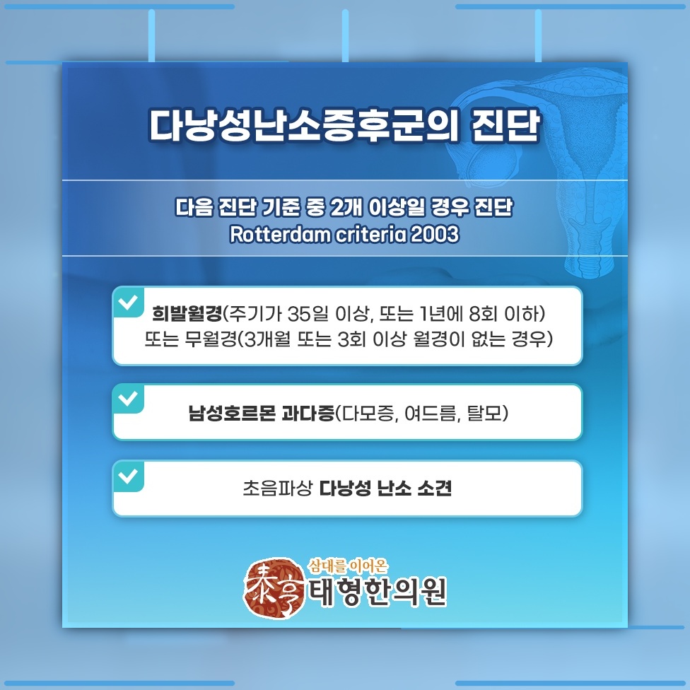 석 달 넘게 생리 주기가 흐트러졌다면 다낭성난소증후군 점검