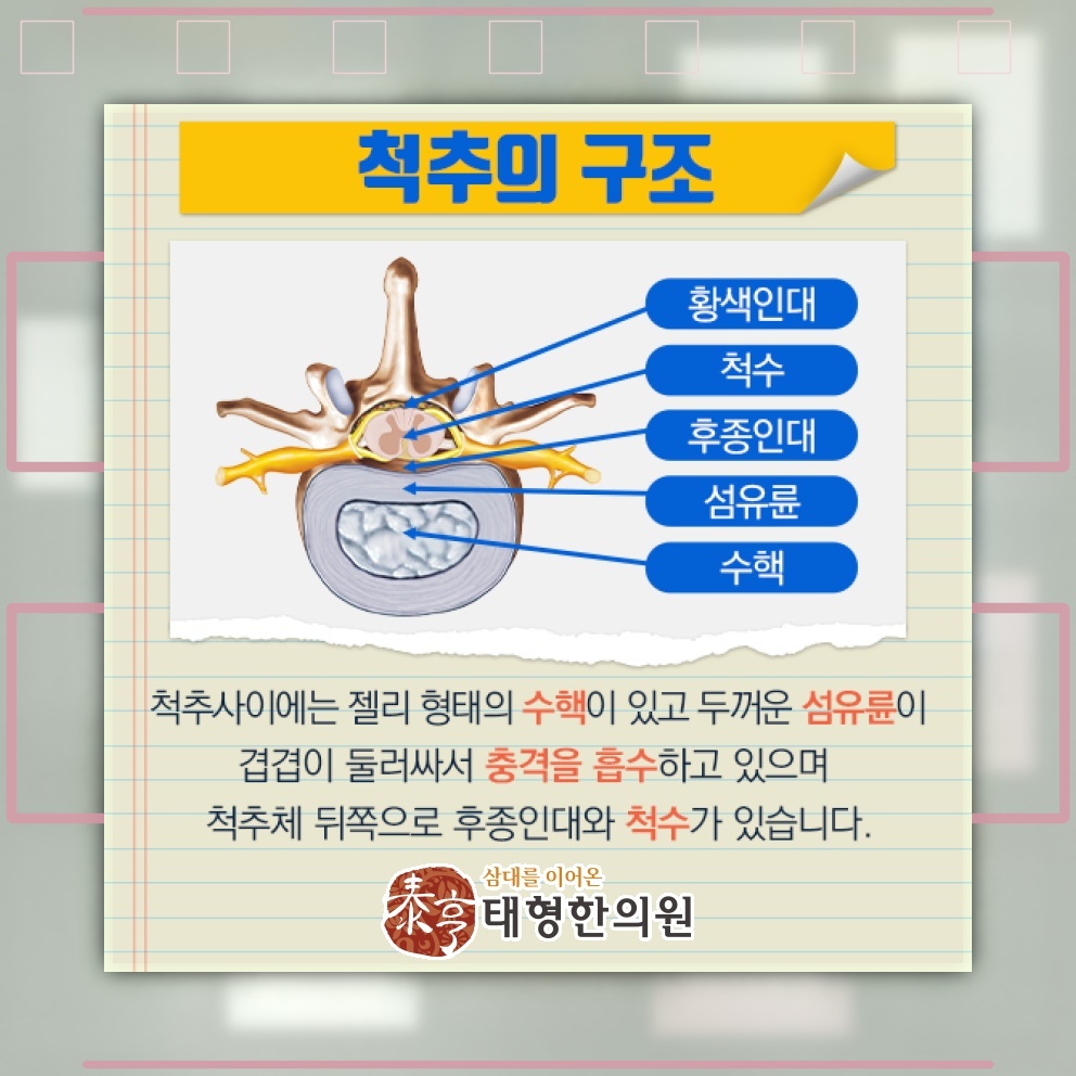 허리디스크로 나타나는 허리 통증과 다리로 뻗는 통증
