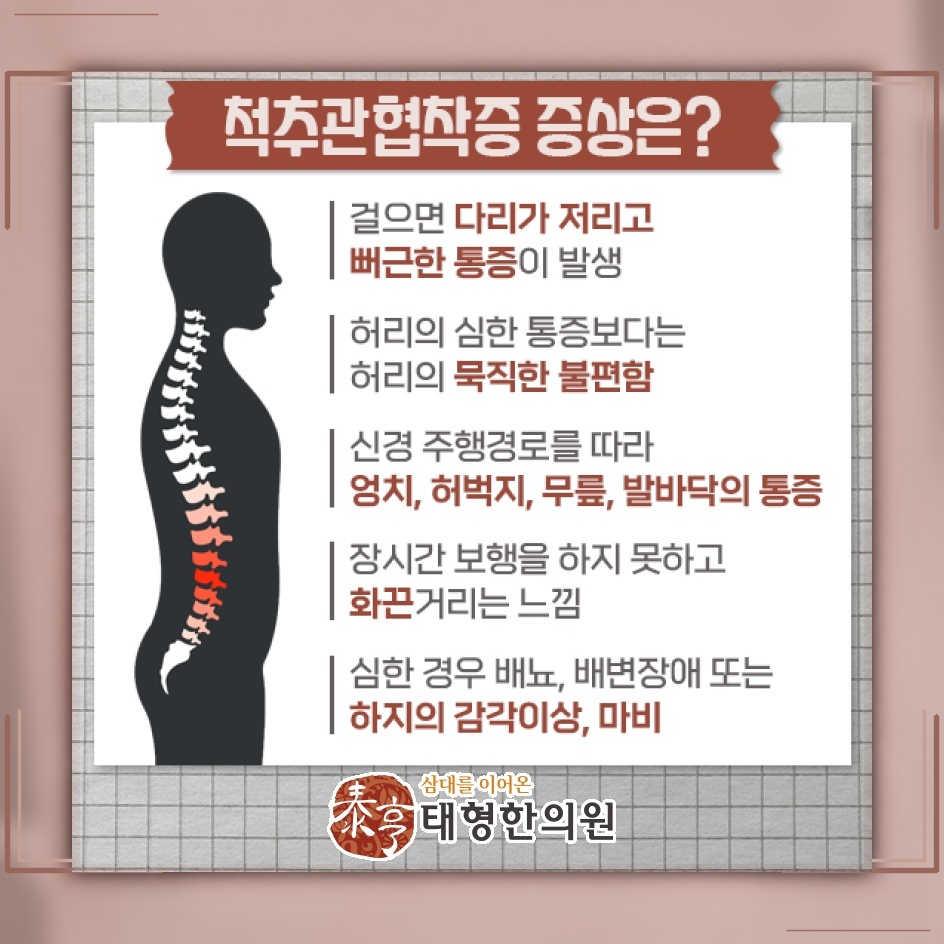 척추관협착증의 상태를 확인하는 진단과 개인별 진료 방향