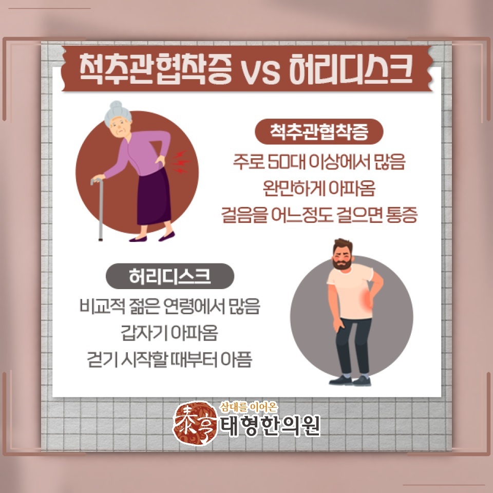 척추관협착증의 상태를 확인하는 진단과 개인별 진료 방향